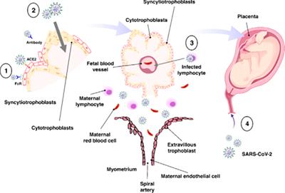 Corrigendum: The effects of COVID-19 on the placenta during pregnancy